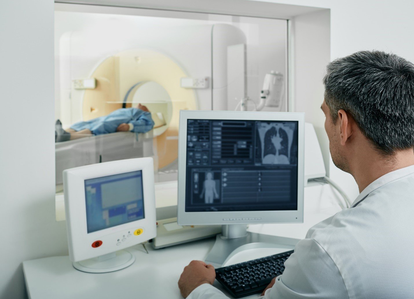 Hope on the Horizon: Innovations in Lung Cancer Treatment